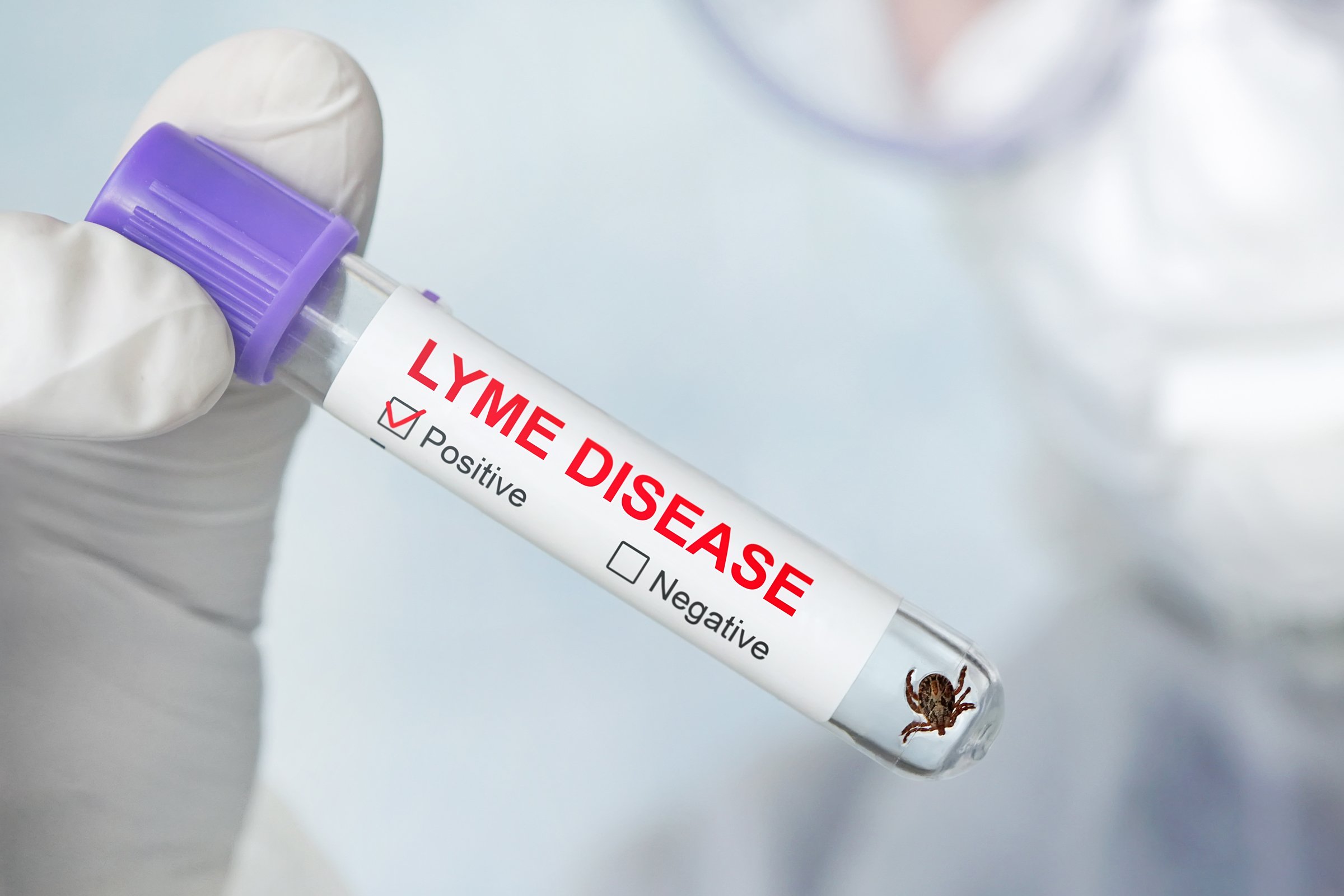 lyme-kór