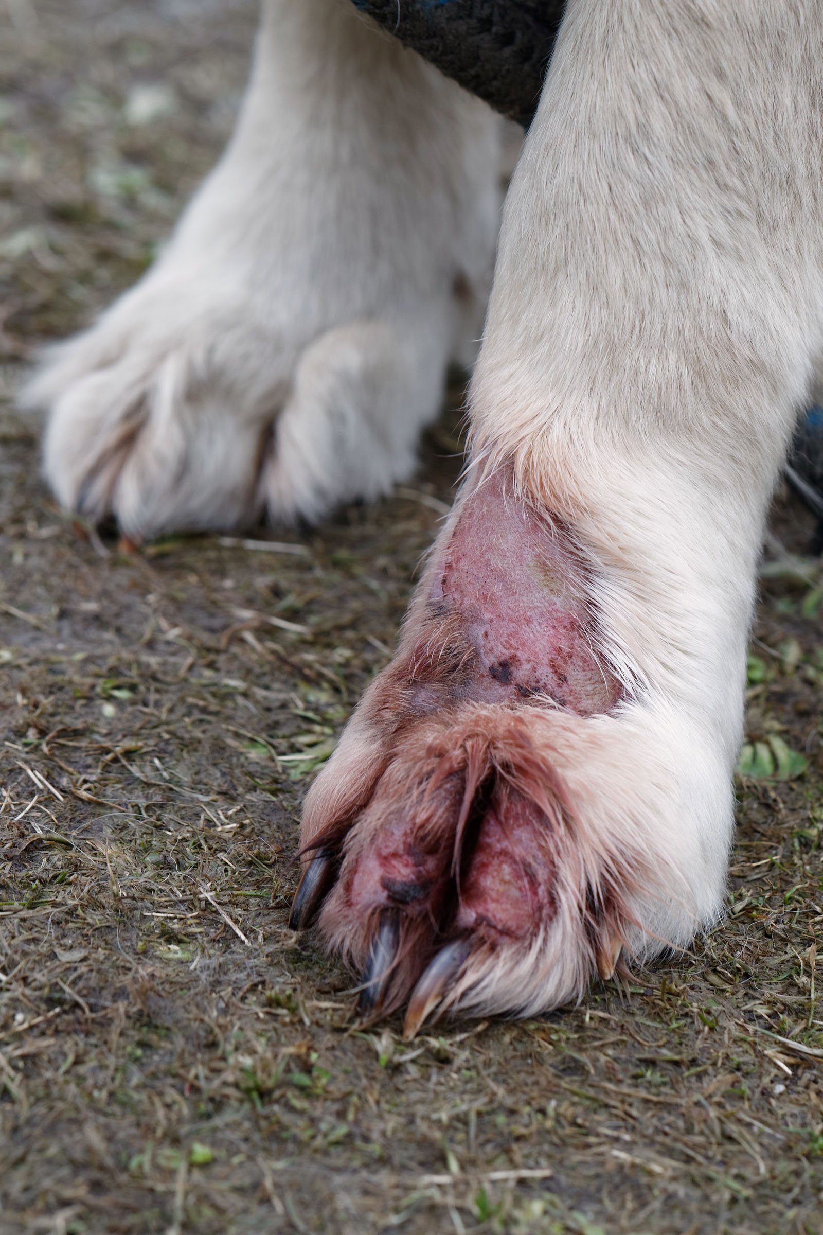 granuloma